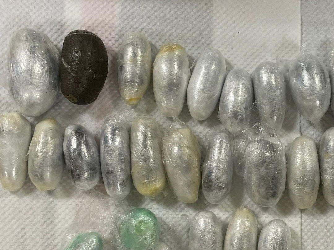 کشف ۴۱۲ گرم حشیش بلعیده‌شده قاچاق مواد مخدر از طریق بلعیدن