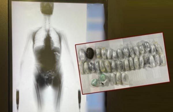 کشف ۴۱۲ گرم حشیش بلعیده‌شده قاچاق مواد مخدر از طریق بلعیدن