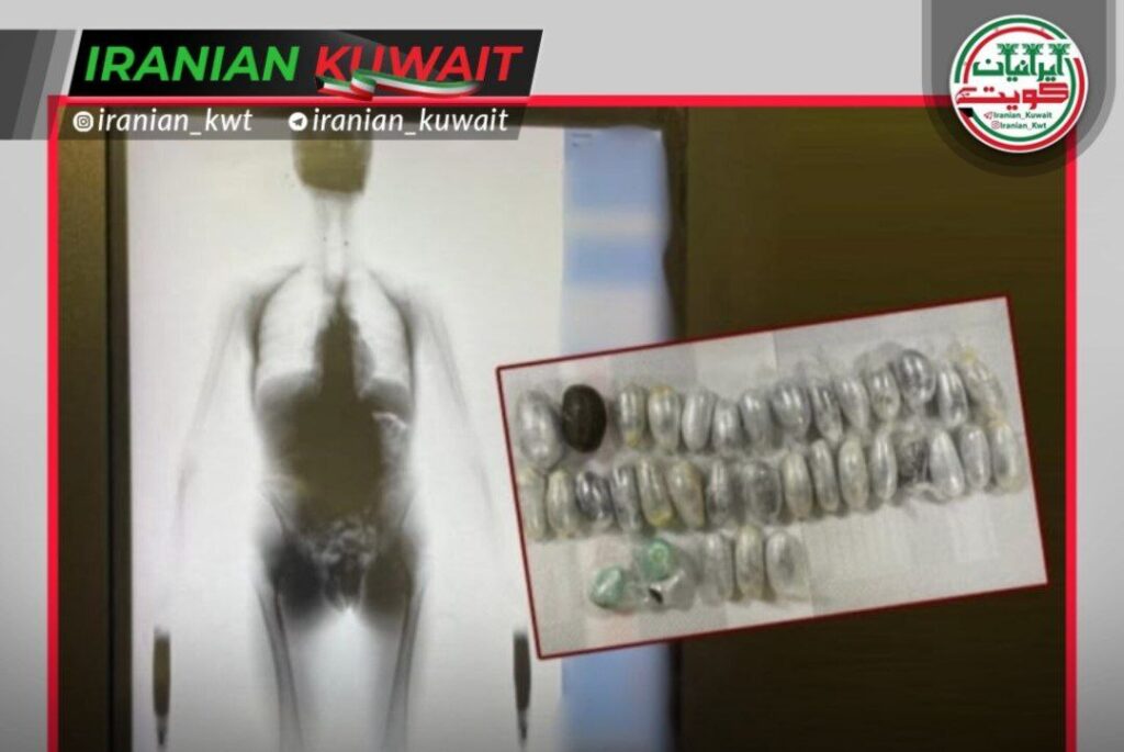 کشف ۴۱۲ گرم حشیش بلعیده‌شده قاچاق مواد مخدر از طریق بلعیدن